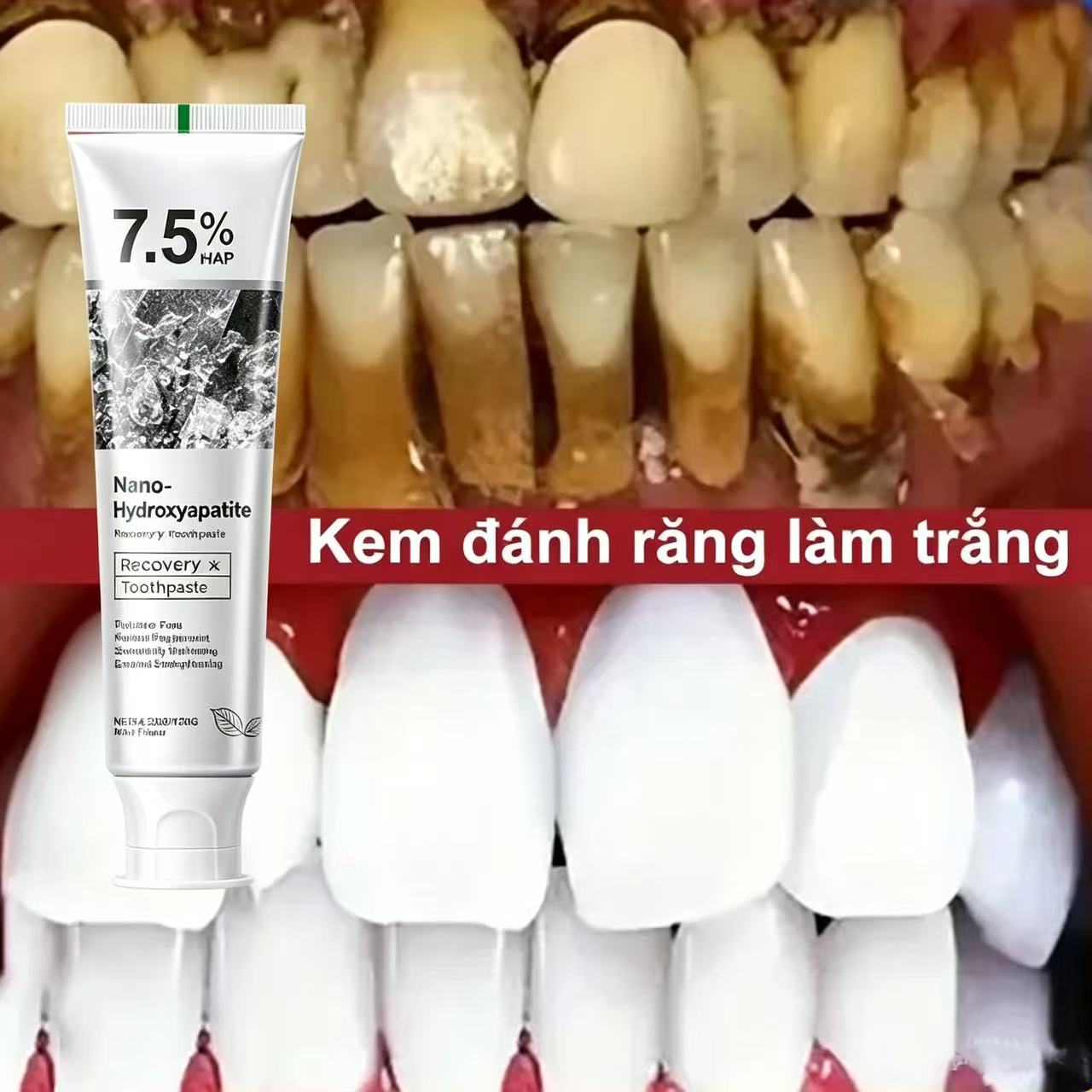 Teeth Whitening That Works - 7.5% ハイドロキシアパタイトプロバイオティクスホワイトニング歯磨き粉エナメル口腔修復口臭清涼歯ホワイトナー歯磨き粉 120 グラム