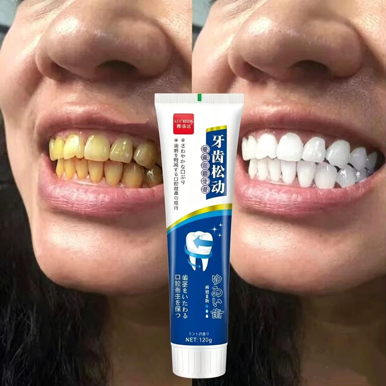 ゆるんだ歯を補修する 日本輸入歯磨き粉 一年中使える口腔ケア - Teeth Whitening Japan のレビューと価格