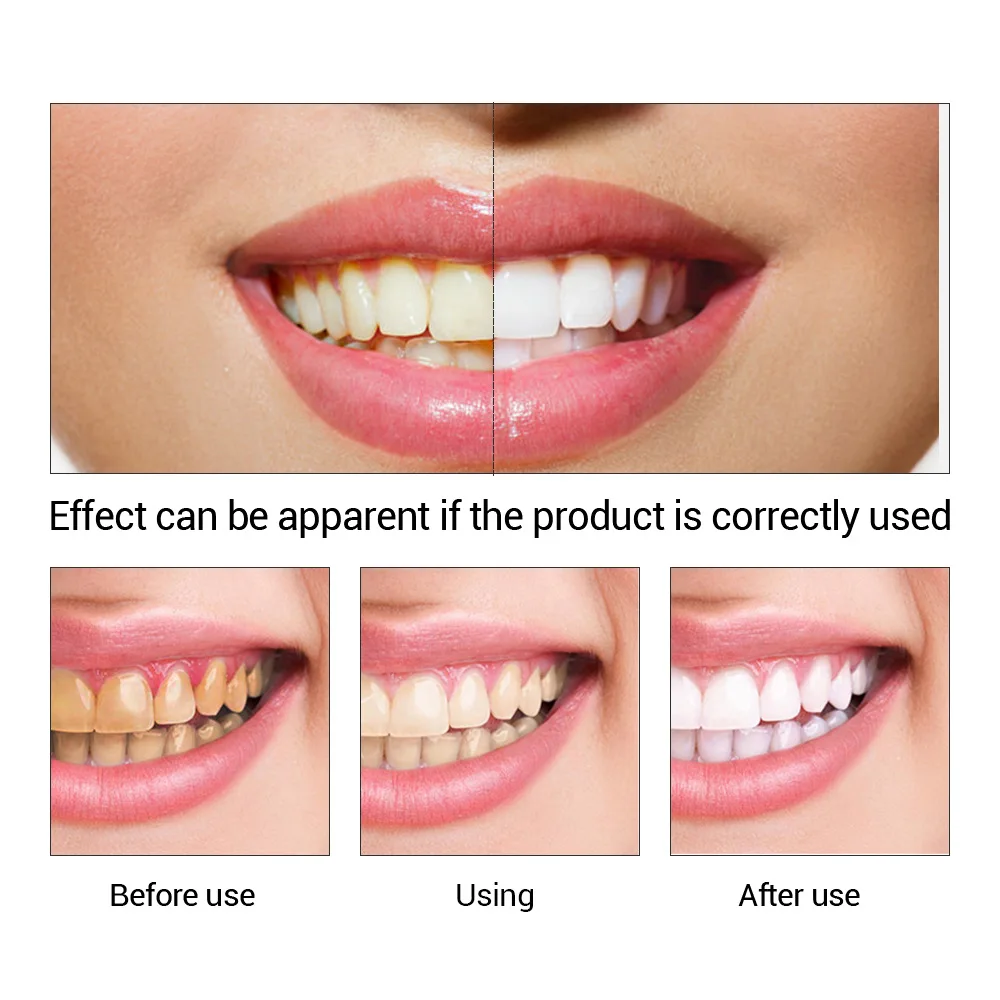 歯のホワイトニングエッセンス,口腔衛生,歯のホワイトニング, - Teeth Whitening From Home のレビューと価格