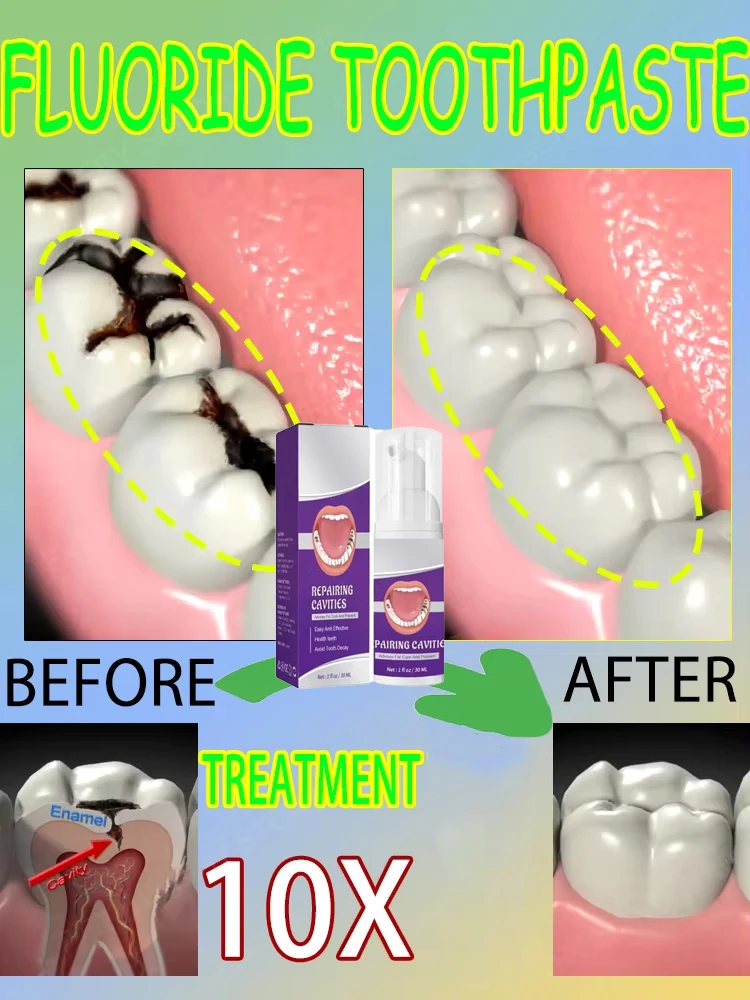 科学的な修復により、虫歯を取り除き、歯垢をきれいにし、歯を白 - Teeth Whitening That Works のレビューと価格