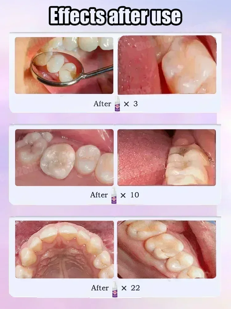 科学的な修復により、虫歯を取り除き、歯垢をきれいにし、歯を白 - Teeth Whitening That Works のレビューと価格