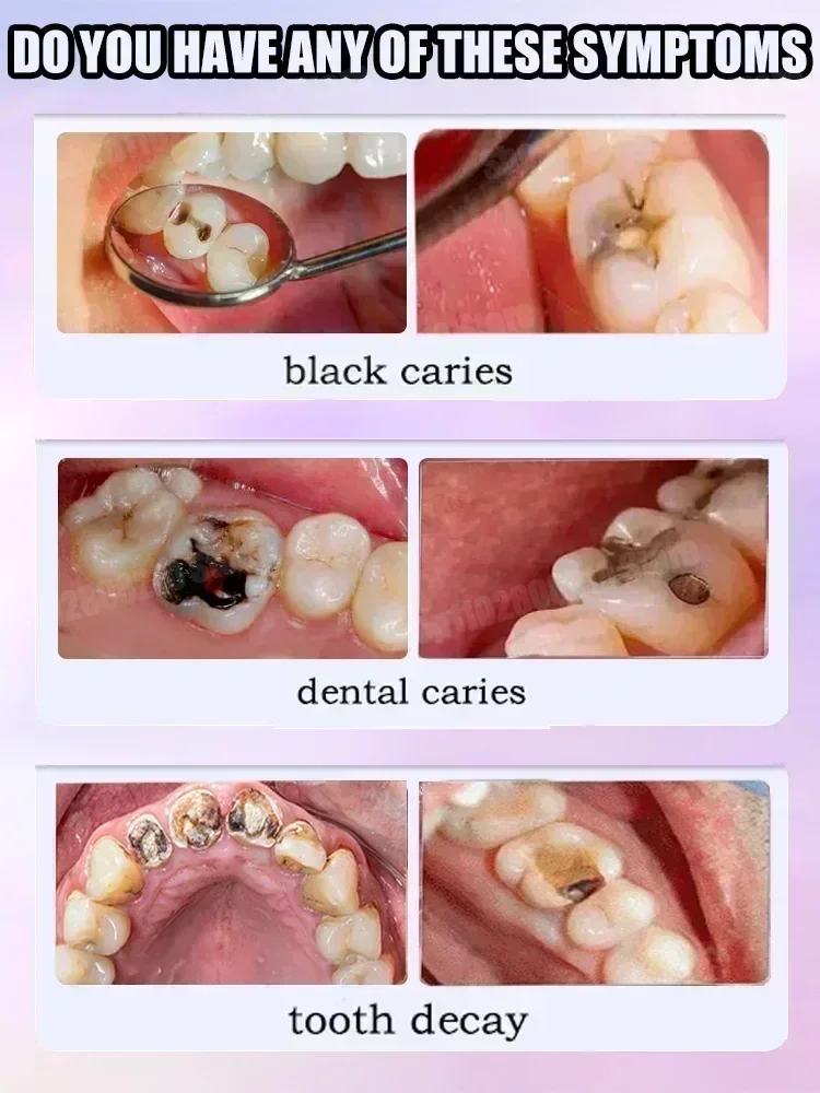 科学的な修復により、虫歯を取り除き、歯垢をきれいにし、歯を白 - Teeth Whitening That Works のレビューと価格