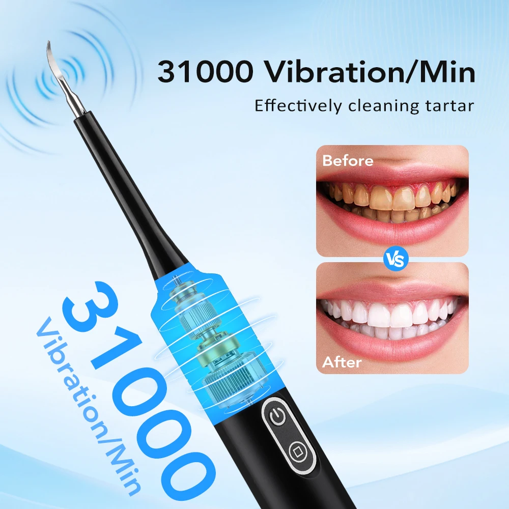 電気音波振動歯科用スケーラー歯のホワイトニング歯垢除去コーヒ - Electric Toothbrush Sonic のレビューと価格